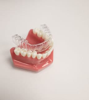 3D printing for precision fit